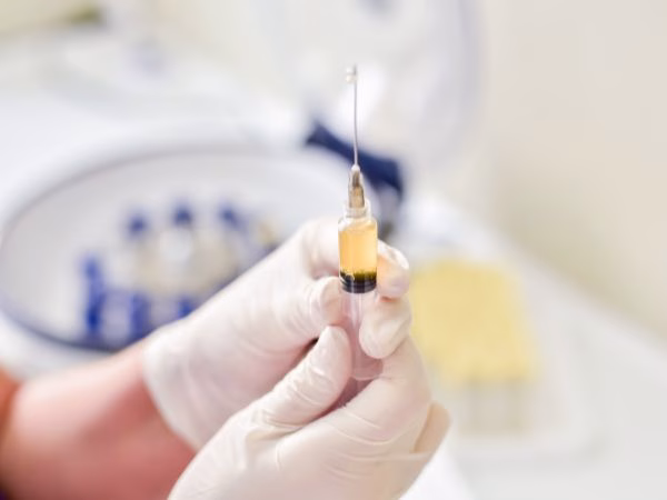 Plasma rico en plaquetas (PRP)